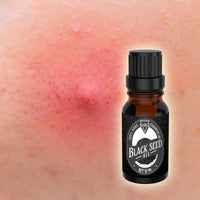 Black Seed Carrier Oil